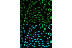 Immunofluorescence analysis of A549 cell using PCNA antibody. (PCNA anticorps  (AA 1-261))