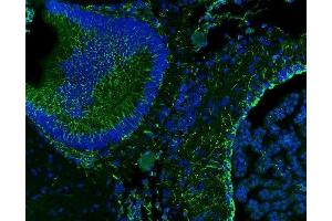 anti-Vimentin (VIM) (AA 435-466), (C-Term) antibody