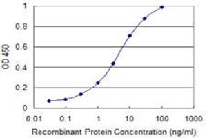 Detection limit for recombinant GST tagged SIRT1 is 0. (SIRT1 anticorps  (AA 456-555))