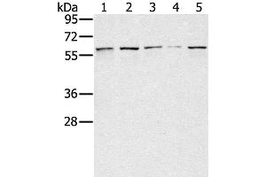 Western Blot analysis of Lovo, hela, K562, Raji and hepg2 cell using SESN1 Polyclonal Antibody at dilution of 1:200 (SESN1 anticorps)