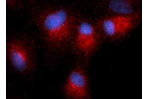 Immunofluorescence (IF) image for anti-Centromere Protein B (CENPB) antibody (PE) (ABIN5567026) (CENPB anticorps  (PE))