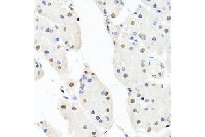 Immunohistochemistry of paraffin-embedded human stomach using CHRAC1 antibody. (CHRAC1 anticorps  (AA 1-131))