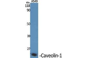 Western Blot (WB) analysis of specific cells using Caveolin-1 Polyclonal Antibody.