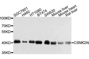 Western blot analysis of extracts of various cells, using CSNK2A1 antibody. (CSNK2A1/CK II alpha anticorps)