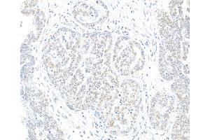 Immunohistochemistry (IHC) image for anti-H2A Histone Family, Member X (H2AFX) (C-Term) antibody (ABIN7449409) (H2AFX anticorps  (C-Term))