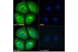 ABIN335161 Immunofluorescence analysis of paraformaldehyde fixed MCF7 cells, permeabilized with 0.