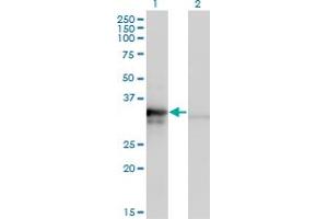 Western Blot analysis of MRPL1 expression in transfected 293T cell line by MRPL1 monoclonal antibody (M02), clone 2C4.