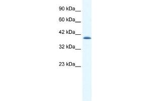 WB Suggested Anti-CATSPER2 Antibody Titration:  1. (CATSPER2 anticorps  (N-Term))
