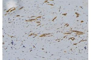 ABIN6279242 at 1/100 staining Human lung tissue by IHC-P. (CHST12 anticorps  (C-Term))