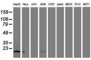 Image no. 2 for anti-NADH Dehydrogenase (Ubiquinone) 1 alpha Subcomplex, 7, 14.5kDa (NDUFA7) antibody (ABIN1499660) (NDUFA7 anticorps)