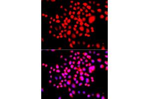 Immunofluorescence analysis of A549 cells using STK19 antibody. (STK19 anticorps)