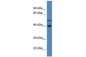 Western Blot showing HSDL1 antibody used at a concentration of 1 ug/ml against Fetal Liver Lysate (HSDL1 anticorps  (C-Term))