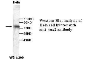 Image no. 1 for anti-Prostaglandin-Endoperoxide Synthase 2 (Prostaglandin G/H Synthase and Cyclooxygenase) (PTGS2) antibody (ABIN790887) (PTGS2 anticorps)
