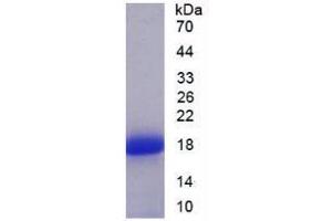 SDS-PAGE analysis of Human SFRP5 Protein. (SFRP5 Protéine)