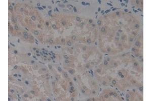 Detection of ALOX12 in Human Kidney Tissue using Polyclonal Antibody to Arachidonate-12-Lipoxygenase (ALOX12)