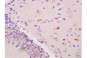 Formalin-fixed and paraffin embedded rat brain labeled with Anti-SLCO2A1 Polyclonal Antibody, Unconjugated (ABIN1386754) at 1:200 followed by conjugation to the secondary antibody and DAB staining