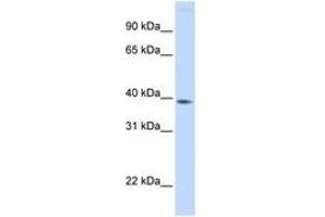 Image no. 1 for anti-Family with Sequence Similarity 76, Member B (FAM76B) (AA 108-157) antibody (ABIN6741165) (FAM76B anticorps  (AA 108-157))