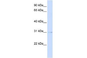 PVRIG antibody used at 1 ug/ml to detect target protein. (PVRIG anticorps  (Middle Region))