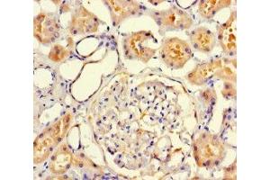 Immunohistochemistry of paraffin-embedded human kidney tissue using ABIN7175549 at dilution of 1:100 (VMO1 anticorps  (AA 25-202))