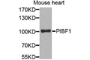 Western blot analysis of extracts of mouse heart, using PIBF1 antibody. (PIBF1 anticorps)