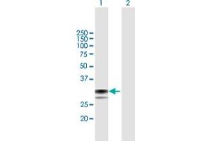 Western Blot analysis of SPSB1 expression in transfected 293T cell line by SPSB1 MaxPab polyclonal antibody. (SPSB1 anticorps  (AA 1-273))