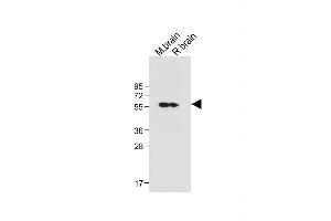 All lanes : Anti-CK2D (CK2 delta) Antibody (C-term) at 1:1000 dilution Lane 1: Mouse brain tissue lysate Lane 2: Rat brain tissue lysate Lysates/proteins at 20 μg per lane. (CAMK2D anticorps  (C-Term))