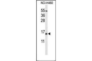 Western blot analysis of KCE1L Antibody (Center) in NCI-H460 cell line lysates (35ug/lane). (KCNE1-Like anticorps  (Middle Region))