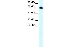 WB Suggested Anti-ZFP67 Antibody Titration:  1. (ZBTB7B anticorps  (Middle Region))