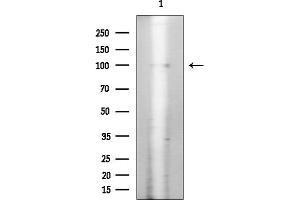 anti-Insulin Receptor (INSR) (pTyr1355) antibody