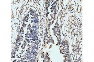 IHC analysis of MSK2/RSK-B/RPS6KA4 using anti-MSK2/RSK-B/RPS6KA4 antibody (ABIN7601238).