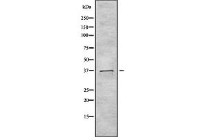 Western blot analysis of TAS2R40 using 293 whole cell lysates