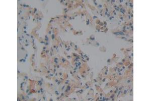 IHC-P analysis of Human Tissue, with DAB staining. (NBL1 anticorps  (AA 17-181))