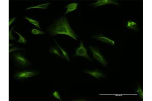 Immunofluorescence of monoclonal antibody to ATF6B on HeLa cell. (ATF6B anticorps  (AA 2-88))