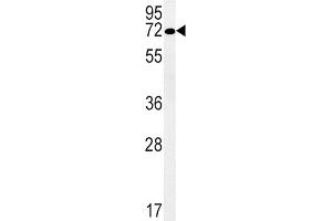 Western Blotting (WB) image for anti-Solute Carrier Family 19, Member 3 (Slc19a3) antibody (ABIN3002312) (SLC19A3 anticorps)