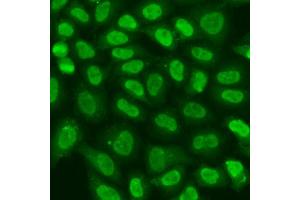 Immunofluorescence analysis of U2OS cells using TERF2IP antibody (ABIN6293618) at dilution of 1:100. (RAP1 anticorps)