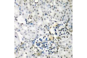 Immunohistochemistry of paraffin-embedded rat kidney using SF3B3 antibody at dilution of 1:200 (40x lens). (SF3B3 anticorps)