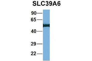 Host:  Rabbit  Target Name:  WT1  Sample Type:  721_B  Antibody Dilution:  1.