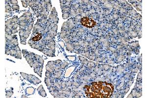 ABIN6262752 and ABIN6278170 at 1/100 staining Rat pancreatic tissue by IHC-P. (KCNJ2 anticorps  (C-Term))