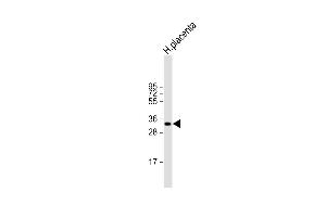 Anti-HPGD Antibody (C-term) at 1:2000 dilution + human placenta lysate Lysates/proteins at 20 μg per lane. (HPGD anticorps  (C-Term))