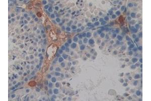 Detection of GAL4 in Mouse Testis Tissue using Polyclonal Antibody to Galectin 4 (GAL4)