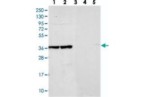 Western blot analysis of Lane 1: RT-4, Lane 2: U-251 MG, Lane 3: Human Plasma, Lane 4: Liver, Lane 5: Tonsil with ACTL6B polyclonal antibody  at 1:250-1:500 dilution. (Actin-Like 6B anticorps)