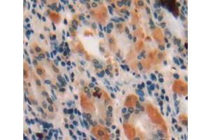 Used in DAB staining on fromalin fixed paraffin-embedded stomach tissue