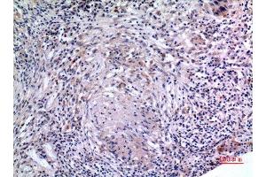 Immunohistochemistry (IHC) analysis of paraffin-embedded Human Lung, antibody was diluted at 1:100. (IL-6 anticorps  (Internal Region))