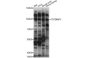Western blot analysis of extracts of various cell lines, using TGFBRAP1 antibody (ABIN6292312) at 1:1000 dilution. (TGFBRAP1 anticorps)