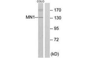 Western Blotting (WB) image for anti-MN1 proto-oncogene (MN1) (AA 821-870) antibody (ABIN2889560) (Meningioma 1 anticorps  (AA 821-870))