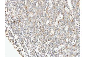 IHC-P Image Immunohistochemical analysis of paraffin-embedded BT483 xenograft, using EIF3F, antibody at 1:100 dilution.