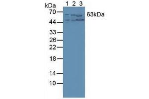 Western blot analysis of (1) Human PC-3 Cells, (2) Human Liver Tissue and (3) Mouse Kidney Tissue. (RORA anticorps  (AA 164-401))