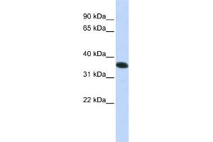 WB Suggested Anti-C21orf59 Antibody Titration:  0. (C21orf59 anticorps  (N-Term))