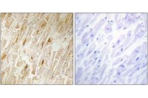 Immunohistochemistry analysis of paraffin-embedded human heart tissue, using BCA3 Antibody. (AKIP1 anticorps  (AA 111-160))