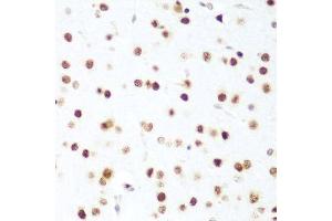 Immunohistochemistry of paraffin-embedded mouse brain using CDK1 antibody.